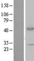 ASS1 / ASS Protein - Western validation with an anti-DDK antibody * L: Control HEK293 lysate R: Over-expression lysate