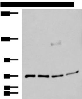ASTE1 Antibody - Western blot analysis of A549 A172 TM4 and PC3 cell lysates  using ASTE1 Polyclonal Antibody at dilution of 1:600