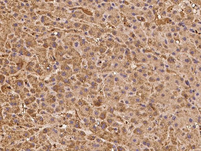 ASTL Antibody - Immunochemical staining of human ASTL in human liver with rabbit polyclonal antibody at 1:100 dilution, formalin-fixed paraffin embedded sections.