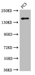 ASTN2 Antibody - Positive WB detected in:PC3 whole cell lysate;All lanes:ASTN2 antibody at 3.4?g/ml;Secondary;Goat polyclonal to rabbit IgG at 1/50000 dilution;Predicted band size:149,143,148,50,45 KDa;Observed band size: 149 KDa;