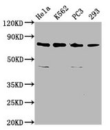 ASUN / C12orf11 Antibody - Western Blot Positive WB detected in: Hela whole cell lysate, K562 whole cell lysate, PC3 whole cell lysate, 293 whole cell lysate All Lanes: INTS13 antibody at 3.4µg/ml Secondary Goat polyclonal to rabbit IgG at 1/50000 dilution Predicted band size: 81, 69 KDa Observed band size: 81 KDa
