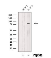 ASUN / C12orf11 Antibody - Western blot analysis of extracts of MCF-7 cells using ASUN antibody. The lane on the left was treated with blocking peptide.