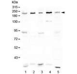 ASXL1 Antibody - Western blot testing of human 1) HeLa, 2) COLO320, 3) 293T, 4) Jurkat and 5) mouse testis lysate with ASXL1 antibody at 0.5ug/ml. Predicted molecular weight ~165 kDa, observed here at ~220 kDa.