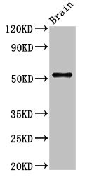 ASZ1 / Orf3 Antibody - Western Blot Positive WB detected in: Rat brain tissue All lanes: ASZ1 antibody at 2.7µg/ml Secondary Goat polyclonal to rabbit IgG at 1/50000 dilution Predicted band size: 54, 53 kDa Observed band size: 54 kDa