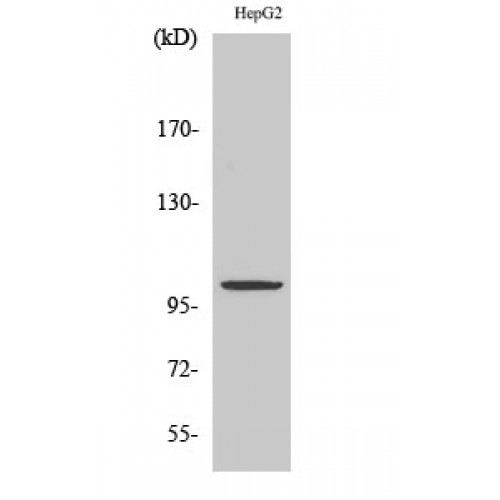 ATAC1 / ZZZ3 Antibody - Western blot of ZZZ3 antibody