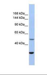 ATAC1 / ZZZ3 Antibody - Jurkat cell lysate. Antibody concentration: 1.0 ug/ml. Gel concentration: 12%.  This image was taken for the unconjugated form of this product. Other forms have not been tested.