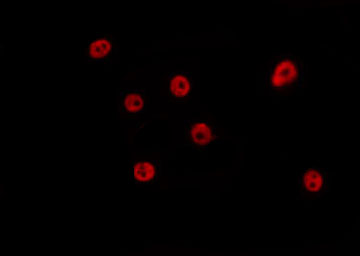 ATAC1 / ZZZ3 Antibody - Staining HeLa cells by IF/ICC. The samples were fixed with PFA and permeabilized in 0.1% Triton X-100, then blocked in 10% serum for 45 min at 25°C. The primary antibody was diluted at 1:200 and incubated with the sample for 1 hour at 37°C. An Alexa Fluor 594 conjugated goat anti-rabbit IgG (H+L) Ab, diluted at 1/600, was used as the secondary antibody.
