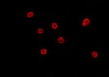 ATAC1 / ZZZ3 Antibody - Staining HeLa cells by IF/ICC. The samples were fixed with PFA and permeabilized in 0.1% Triton X-100, then blocked in 10% serum for 45 min at 25°C. The primary antibody was diluted at 1:200 and incubated with the sample for 1 hour at 37°C. An Alexa Fluor 594 conjugated goat anti-rabbit IgG (H+L) Ab, diluted at 1/600, was used as the secondary antibody.