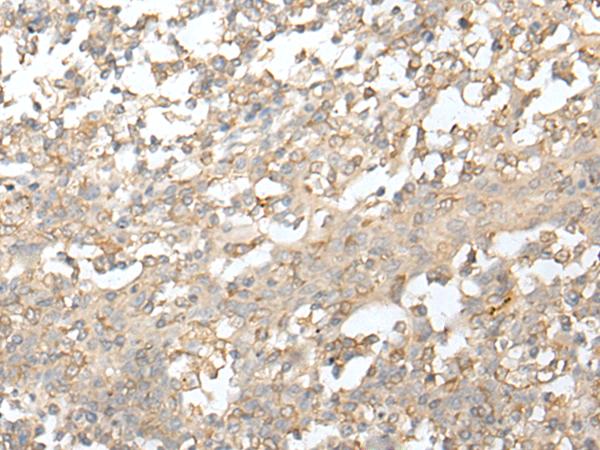 ATAC1 / ZZZ3 Antibody - Immunohistochemistry of paraffin-embedded Human tonsil tissue  using ZZZ3 Polyclonal Antibody at dilution of 1:50(×200)