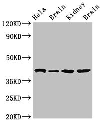 ATAD1 Antibody - Western Blot Positive WB detected in:Hela whole cell lysate,Rat brain tissue,Mouse kidney tissue,Mouse brain tissue All Lanes:ATAD1 antibody at 4µg/ml Secondary Goat polyclonal to rabbit IgG at 1/50000 dilution Predicted band size: 41,33 KDa Observed band size: 41 KDa