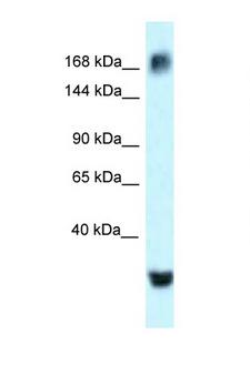 ATAD2 Antibody - ATAD2 antibody Western blot of MCF7 Cell lysate. Antibody concentration 1 ug/ml.  This image was taken for the unconjugated form of this product. Other forms have not been tested.