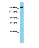 ATAD2B Antibody - Western blot of ATAD2B Antibody - N-terminal region with human HT1080 cells lysate.  This image was taken for the unconjugated form of this product. Other forms have not been tested.