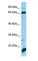 ATAD3A Antibody - ATAD3A antibody Western Blot of Fetal Liver.  This image was taken for the unconjugated form of this product. Other forms have not been tested.