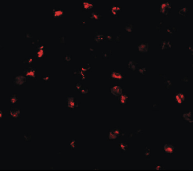 ATAD3A Antibody - Immunofluorescence of ATAD3A in Daudi cells with ATAD3A antibody at 20 ug/ml.