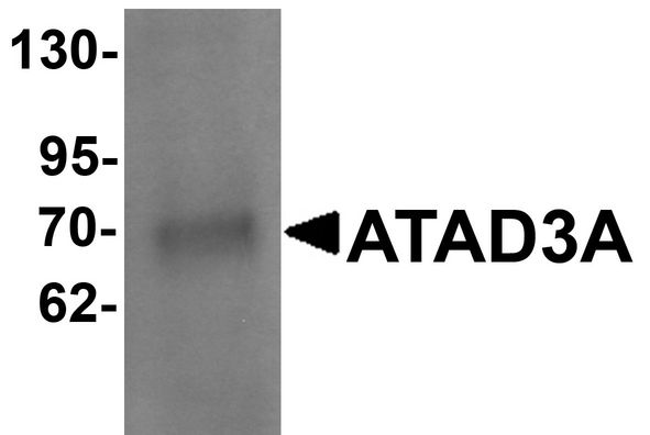 ATAD3A Antibody - Western blot analysis of ATAD3A in Daudi cell lysate with ATAD3A antibody at 1 ug/ml .