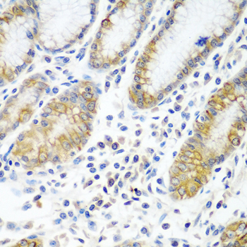 ATAD3A Antibody - Immunohistochemistry of paraffin-embedded human stomach tissue.