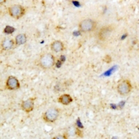 ATAD3A Antibody - Immunohistochemical analysis of ATAD3A staining in mouse brain formalin fixed paraffin embedded tissue section. The section was pre-treated using heat mediated antigen retrieval with sodium citrate buffer (pH 6.0). The section was then incubated with the antibody at room temperature and detected using an HRP conjugated compact polymer system. DAB was used as the chromogen. The section was then counterstained with hematoxylin and mounted with DPX.