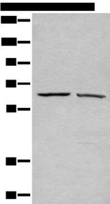 ATAD3A Antibody - Western blot analysis of A431 and Hela cell lysates  using ATAD3A Polyclonal Antibody at dilution of 1:500