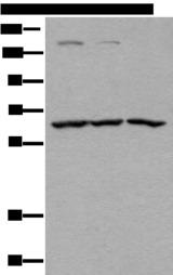 ATAD3A Antibody - Western blot analysis of Raji Hela and A431 cell lysates  using ATAD3A Polyclonal Antibody at dilution of 1:400