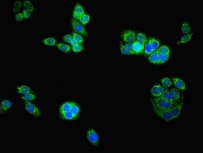 ATAD3B Antibody - Immunofluorescent analysis of PC-3 cells using ATAD3B Antibody at dilution of 1:100 and Alexa Fluor 488-congugated AffiniPure Goat Anti-Rabbit IgG(H+L)