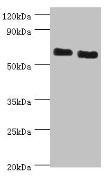 ATAD3B Antibody - Western blot All lanes: ATAD3B antibody at 2µg/ml Lane 1: Jurkat whole cell lysate Lane 2: Hela whole cell lysate Secondary Goat polyclonal to rabbit IgG at 1/10000 dilution Predicted band size: 73, 20, 68 kDa Observed band size: 73 kDa