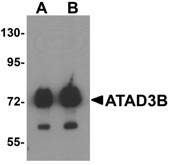 ATAD3B Antibody - Western blot analysis of ATAD3B in human kidney tissue lysate with ATAD3B antibody at (A) 1 and (B) 2 ug/ml .