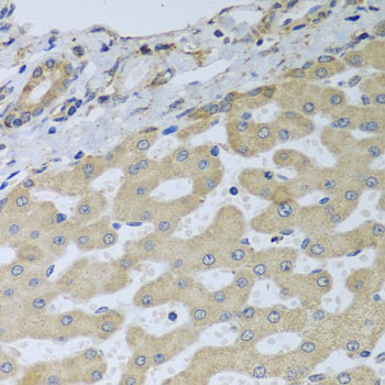 ATAD3B Antibody - Immunohistochemistry of paraffin-embedded human liver injury tissue.