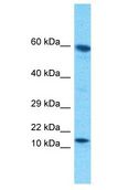 ATAD4 Antibody - ATAD4 antibody Western Blot of ACHN. Antibody dilution: 1 ug/ml.  This image was taken for the unconjugated form of this product. Other forms have not been tested.