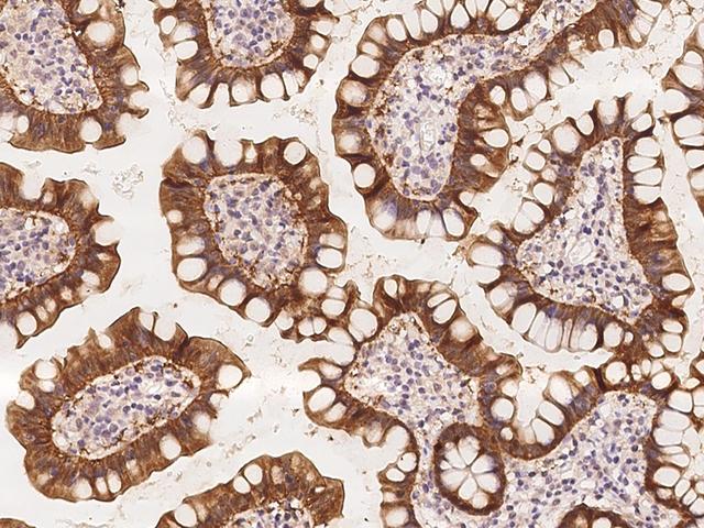 ATAD4 Antibody - Immunochemical staining of human ATAD4 in human small intestine with rabbit polyclonal antibody at 1:500 dilution, formalin-fixed paraffin embedded sections.