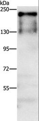 ATAD5 / ELG1 Antibody - Western blot analysis of A431 cell, using ATAD5 Polyclonal Antibody at dilution of 1:750.