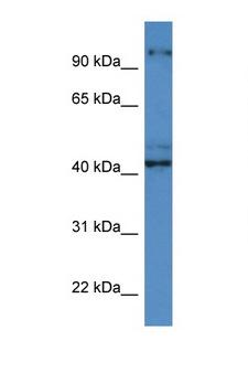 ATCAY / CLAC Antibody - ATCAY antibody Western blot of ACHN Cell lysate. Antibody concentration 1 ug/ml.  This image was taken for the unconjugated form of this product. Other forms have not been tested.