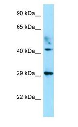ATCAY / CLAC Antibody - ATCAY / CLAC antibody Western Blot of Fetal Thymus.  This image was taken for the unconjugated form of this product. Other forms have not been tested.
