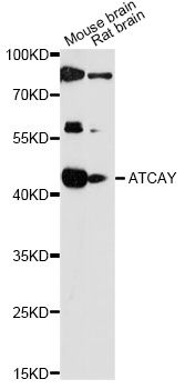 ATCAY / CLAC Antibody - Western blot analysis of extracts of various cell lines, using ATCAY antibody at 1:1000 dilution. The secondary antibody used was an HRP Goat Anti-Rabbit IgG (H+L) at 1:10000 dilution. Lysates were loaded 25ug per lane and 3% nonfat dry milk in TBST was used for blocking. An ECL Kit was used for detection and the exposure time was 90s.
