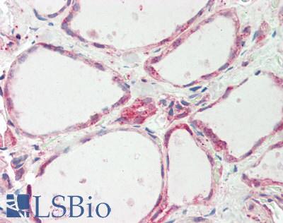 ATE1 Antibody - Human Thyroid: Formalin-Fixed, Paraffin-Embedded (FFPE).  This image was taken for the unconjugated form of this product. Other forms have not been tested.