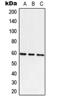 ATE1 Antibody - Western blot analysis of ATE1 expression in A549 (A); Raw264.7 (B); H9C2 (C) whole cell lysates.