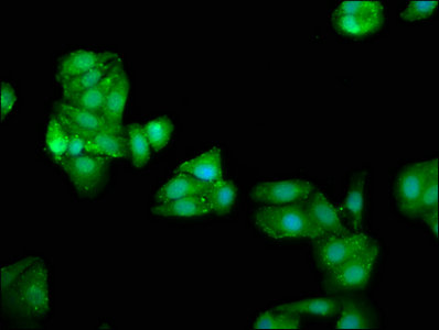 ATE1 Antibody - Immunofluorescence staining of HepG2 cells with ATE1 Antibody at 1:66, counter-stained with DAPI. The cells were fixed in 4% formaldehyde, permeabilized using 0.2% Triton X-100 and blocked in 10% normal Goat Serum. The cells were then incubated with the antibody overnight at 4°C. The secondary antibody was Alexa Fluor 488-congugated AffiniPure Goat Anti-Rabbit IgG(H+L).