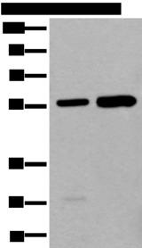 ATE1 Antibody - Western blot analysis of A549 and HEPG2 cell lysates  using ATE1 Polyclonal Antibody at dilution of 1:400