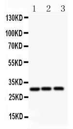 ATF1 Antibody - ATF1 antibody Western blot. All lanes: Anti ATF1 at 0.5 ug/ml. Lane 1: Rat Spleen Tissue Lysate at 50 ug. Lane 2: HELA Whole Cell Lysate at 40 ug. Lane 3: COLO320 Whole Cell Lysate at 40 ug. Predicted band size: 29 kD . Observed band size: 29 kD.