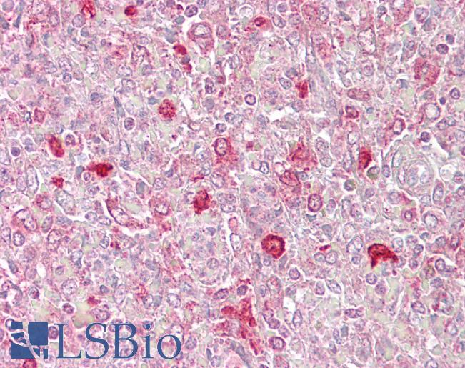 ATF1 Antibody - Anti-ATF1 antibody IHC of human spleen. Immunohistochemistry of formalin-fixed, paraffin-embedded tissue after heat-induced antigen retrieval. Antibody concentration 5 ug/ml.  This image was taken for the unconjugated form of this product. Other forms have not been tested.