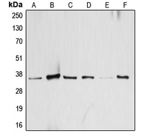 ATF1 Antibody - Western blot analysis of ATF1 expression in HeLa (A); KNRK (B); A431 (C); SP2/0 (D); mouse brain (E); H9C2 (F) whole cell lysates.