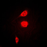 ATF1 Antibody - Immunofluorescent analysis of ATF1 staining in KNRK cells. Formalin-fixed cells were permeabilized with 0.1% Triton X-100 in TBS for 5-10 minutes and blocked with 3% BSA-PBS for 30 minutes at room temperature. Cells were probed with the primary antibody in 3% BSA-PBS and incubated overnight at 4 C in a humidified chamber. Cells were washed with PBST and incubated with a DyLight 594-conjugated secondary antibody (red) in PBS at room temperature in the dark. DAPI was used to stain the cell nuclei (blue).