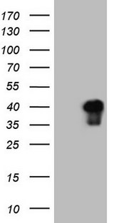 ATF1 Antibody - HEK293T cells were transfected with the pCMV6-ENTRY control. (Left lane) or pCMV6-ENTRY ATF1. (Right lane) cDNA for 48 hrs and lysed. Equivalent amounts of cell lysates. (5 ug per lane) were separated by SDS-PAGE and immunoblotted with anti-ATF1. (1:2000)