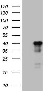 ATF1 Antibody - HEK293T cells were transfected with the pCMV6-ENTRY control. (Left lane) or pCMV6-ENTRY ATF1. (Right lane) cDNA for 48 hrs and lysed
