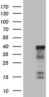 ATF1 Antibody - HEK293T cells were transfected with the pCMV6-ENTRY control. (Left lane) or pCMV6-ENTRY ATF1. (Right lane) cDNA for 48 hrs and lysed