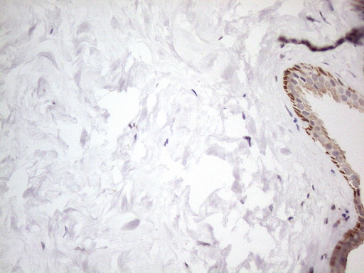 ATF1 Antibody - Immunohistochemical staining of paraffin-embedded Human breast tissue within the normal limits using anti-ATF1 mouse monoclonal antibody. (Heat-induced epitope retrieval by 1mM EDTA in 10mM Tris buffer. (pH8.5) at 120°C for 3 min. (1:150)