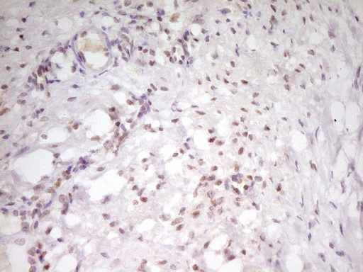 ATF1 Antibody - Immunohistochemical staining of paraffin-embedded Human Ovary tissue within the normal limits using anti-ATF1 mouse monoclonal antibody. (Heat-induced epitope retrieval by 1 mM EDTA in 10mM Tris, pH8.5, 120C for 3min,