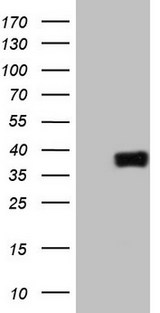 ATF1 Antibody - HEK293T cells were transfected with the pCMV6-ENTRY control (Left lane) or pCMV6-ENTRY ATF1 (Right lane) cDNA for 48 hrs and lysed. Equivalent amounts of cell lysates (5 ug per lane) were separated by SDS-PAGE and immunoblotted with anti-ATF1.