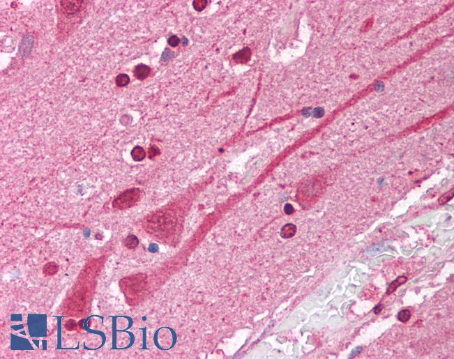 ATF1 Antibody - Anti-ATF1 antibody IHC of human brain, cortex. Immunohistochemistry of formalin-fixed, paraffin-embedded tissue after heat-induced antigen retrieval. Antibody concentration 5 ug/ml.  This image was taken for the unconjugated form of this product. Other forms have not been tested.