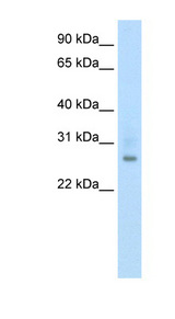 ATF1 Antibody - ATF1 antibody Western blot of Fetal thymus lysate. This image was taken for the unconjugated form of this product. Other forms have not been tested.