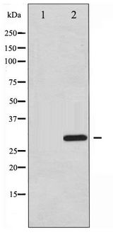 ATF1 Antibody - Western blot of ATF1 phosphorylation expression in Insulin treated HT29 whole cell lysates,The lane on the left is treated with the antigen-specific peptide.